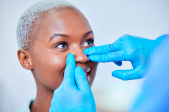 Rhinoplastie